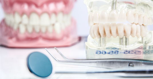 dentiere