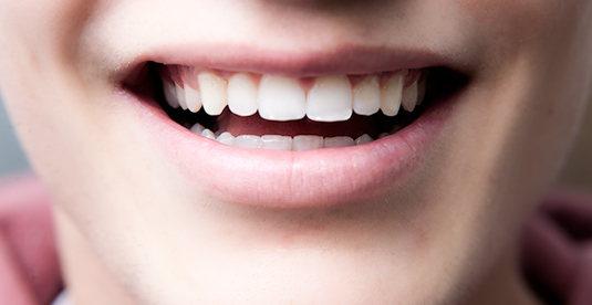 estetica2denti